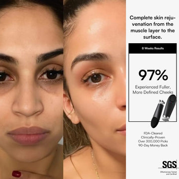 Nuvio 5-in-1 Anti-Aging Wand