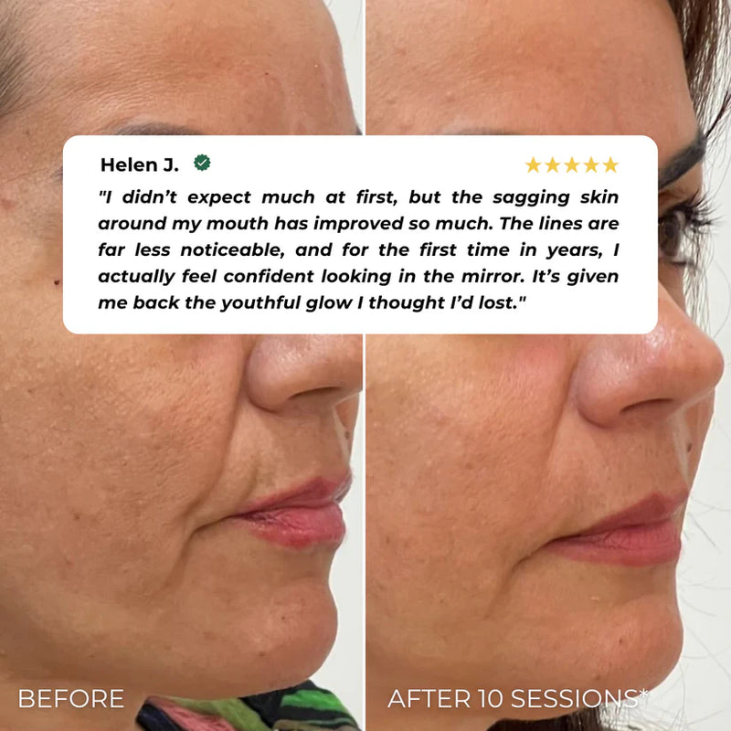 Nuvio EMS Eye Lift Patch