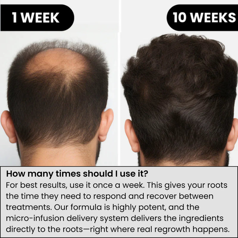 Nuvio Hair Growth Treatment