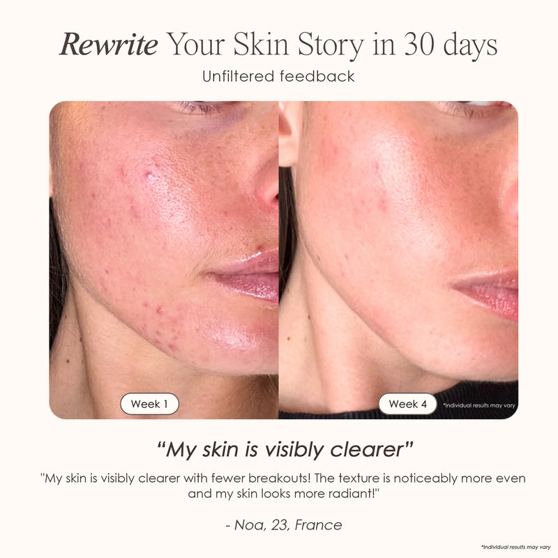 Nuvio 9-Spectrum Anti-Aging Therapy Mask